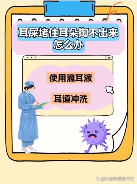 耳屎多了会怎么样_耳屎堵塞耳朵怎么办-第2张图片-俊逸知识馆